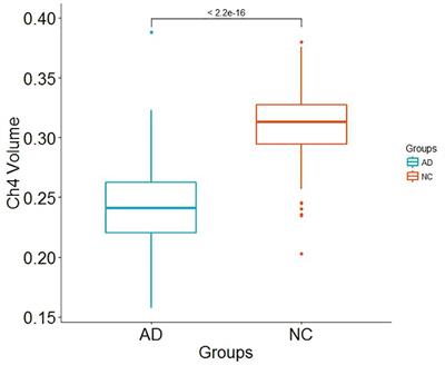 Polygenic Risk Score for Alzheimer’s Disease Is Associated With Ch4 Volume in Normal Subjects